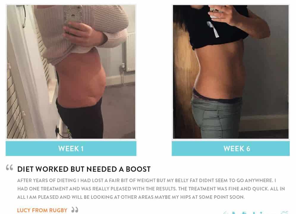 Before and After Dieting Greater London (Hillingdon)