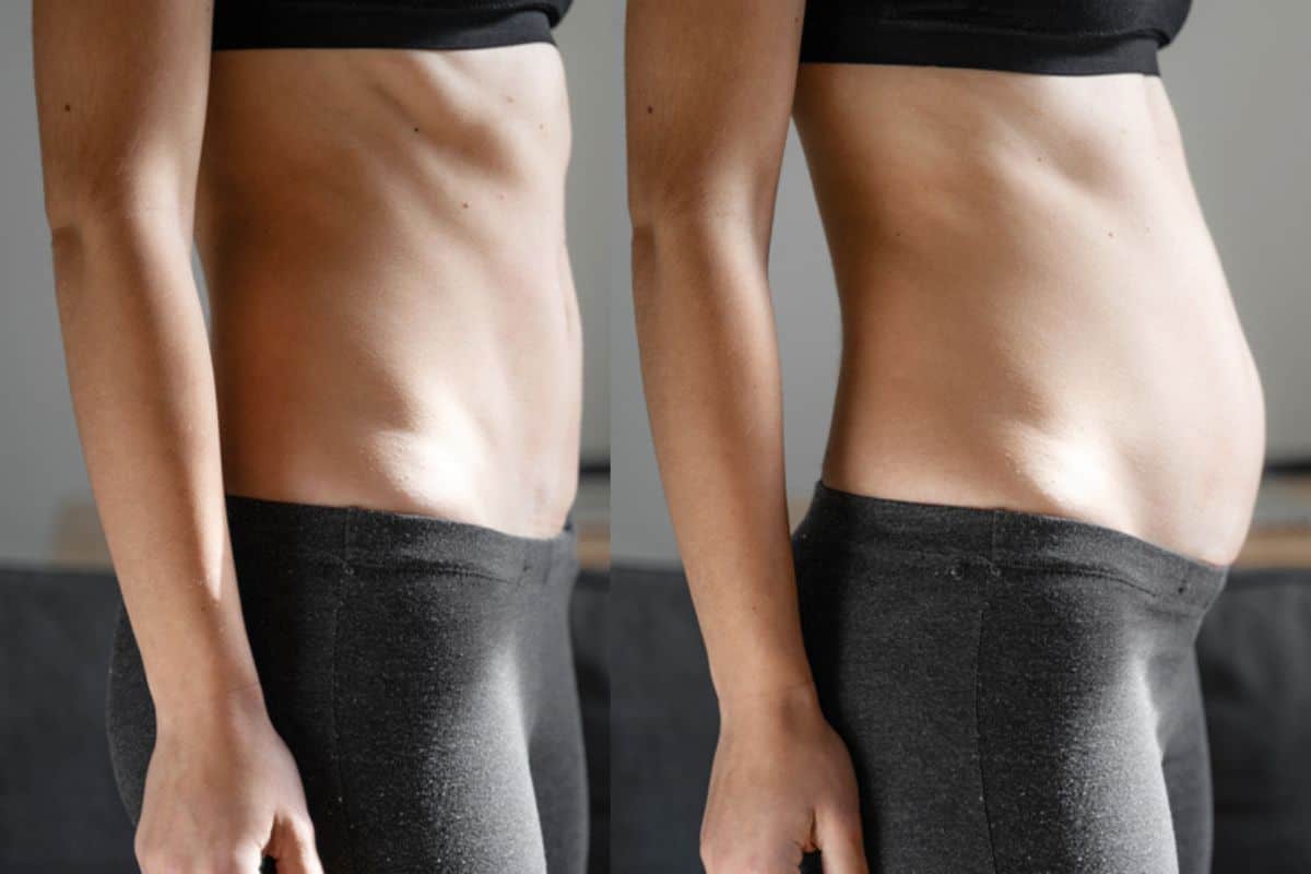 How long does diastasis recti take to improve Greater London (Hillingdon)?