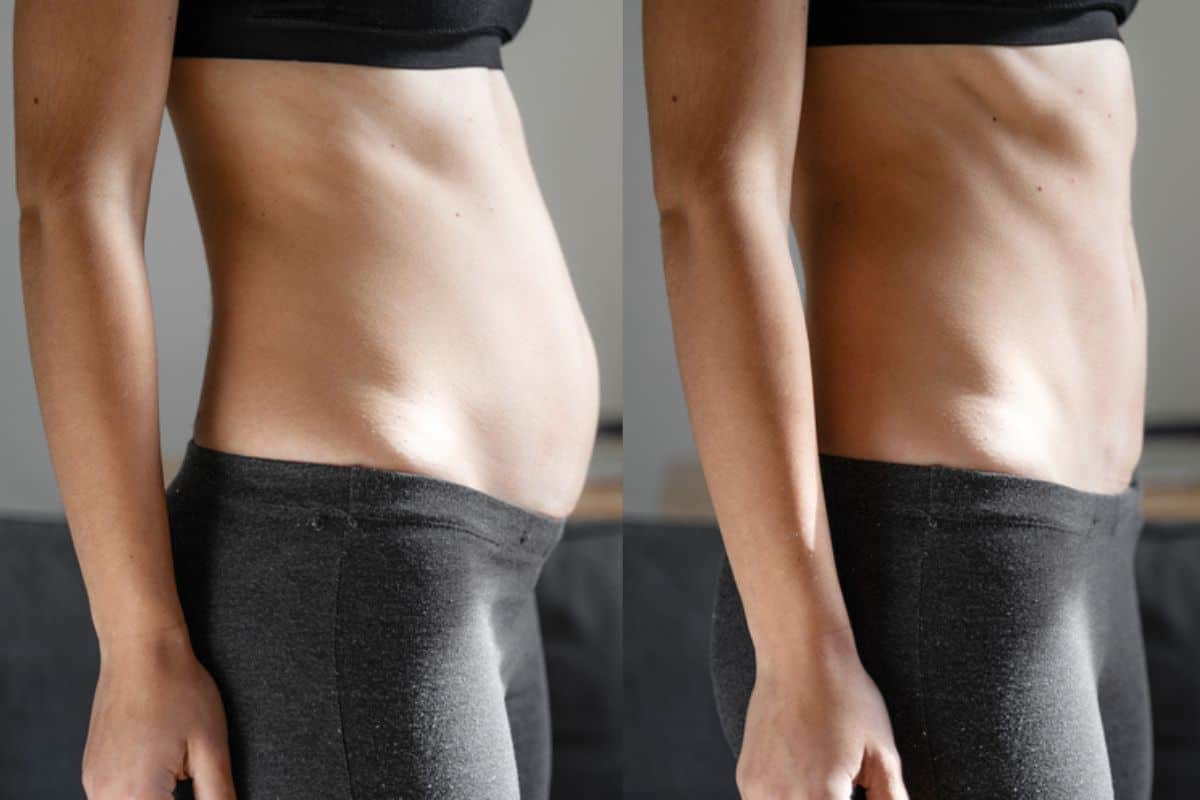 Post-Pregnancy: What Happens to Your Abdominal Muscles After Birth Greater London (Hillingdon)