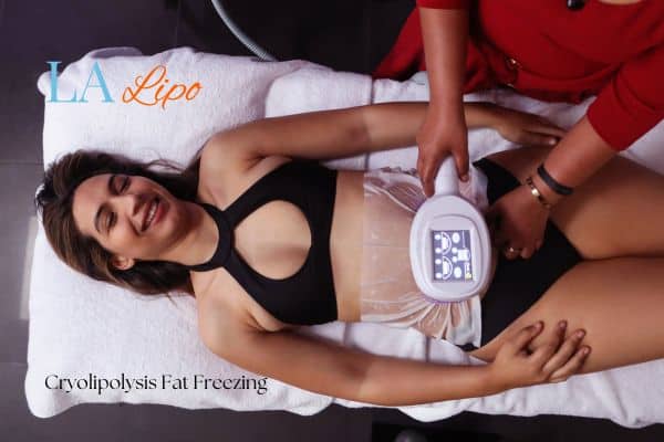woman getting cryolipolysis Greater London (Hillingdon)