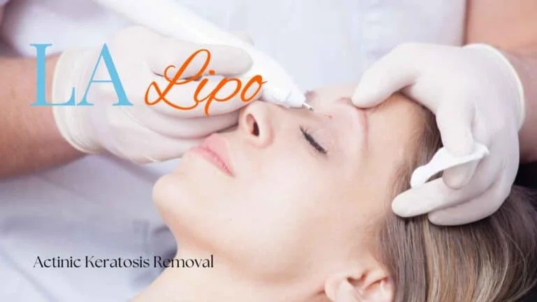 Woman receiving Actinic Keratosis Removal Treatment Greater London (Hillingdon)