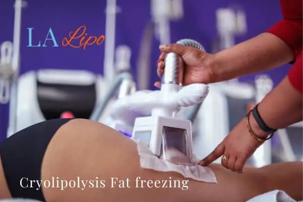 women getting fat freezing Greater London (Hillingdon)