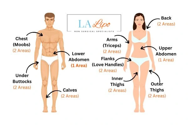 LA LIPO Cryolipolysis Areas Greater London (Hillingdon)