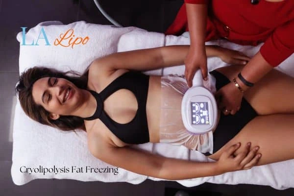 woman getting cryolipolysis Greater London (Hillingdon)