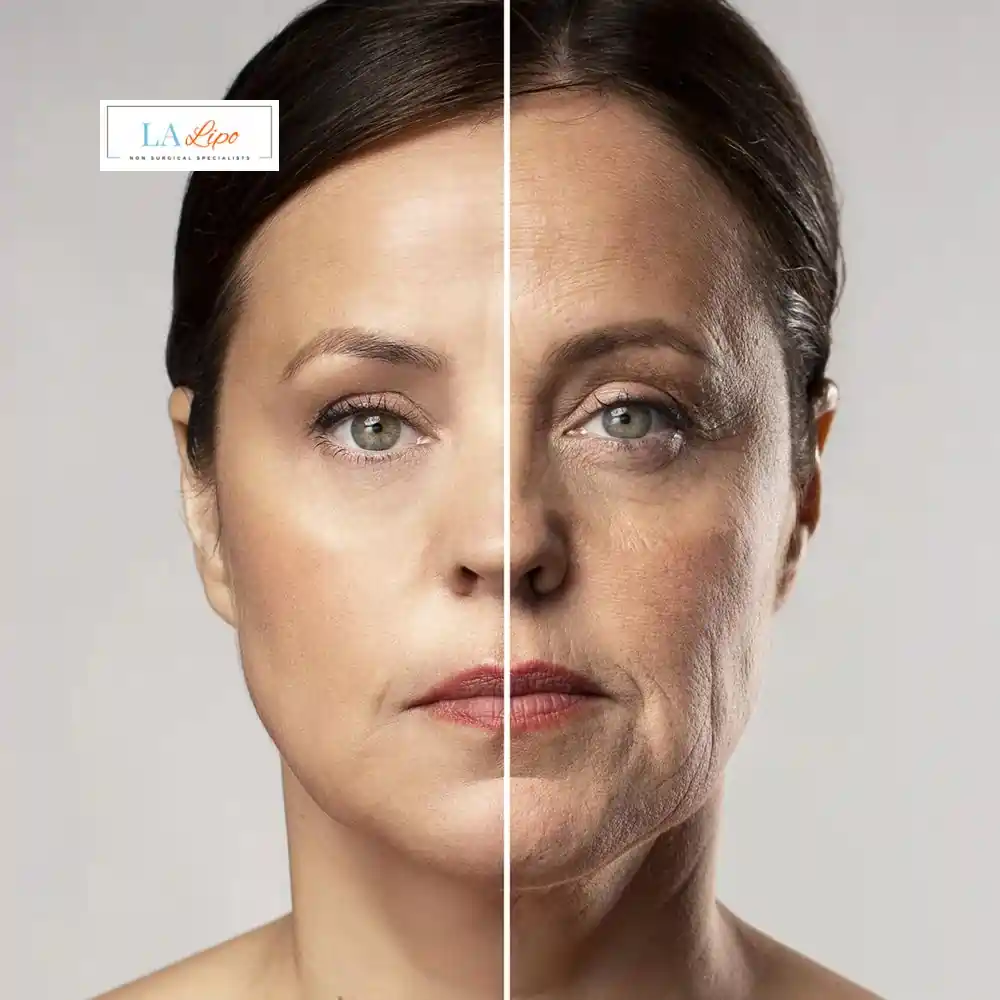 How Can You Tell If Non-Surgical Skin Tightening Is Right for You Greater London (Hillingdon)?