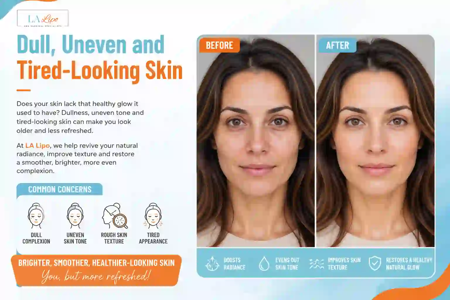Sign #5: Dull, Uneven and Tired-Looking Skin Greater London (Hillingdon)