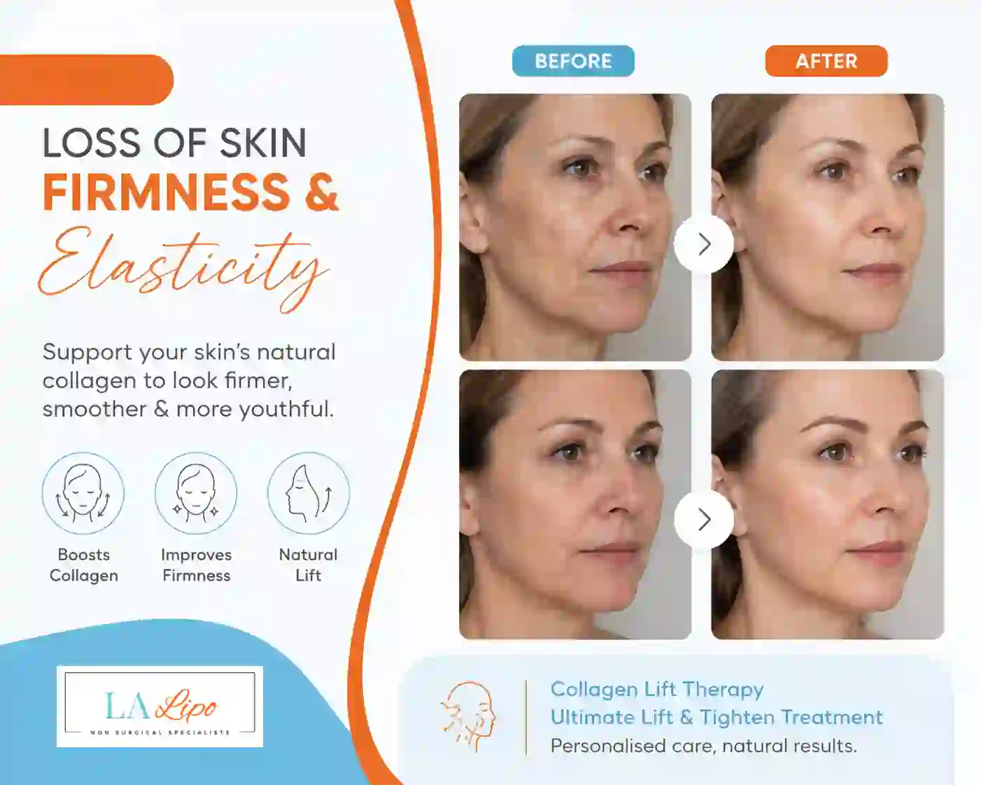 Sign #7: Loss of Skin Firmness and Elasticity Greater London (Hillingdon)